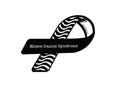 Case 3 : Extreme flexibility and joint dislocations: Ehler Danlos Syndrome